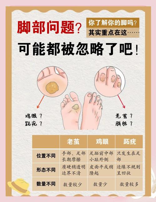 脚下的正常生活最新指南:警惕脚部疾病信号,呵护健康足部